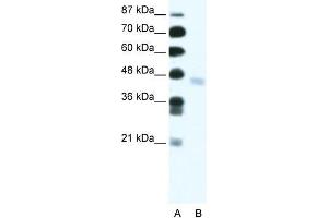 Human Jurkat; WB Suggested Anti-ZNF312 Antibody Titration: 2. (FEZF2 antibody  (N-Term))