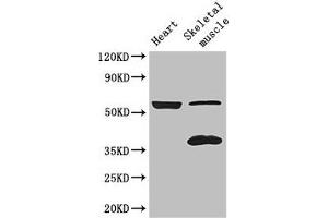 Western Blot Positive WB detected in: Mouse heart tissue, Mouse skeletal muscle tissue All lanes: IQCG antibody at 3. (IQCG antibody  (AA 1-134))