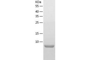 Western Blotting (WB) image for Tumor Necrosis Factor Receptor Superfamily, Member 17 (TNFRSF17) (AA 78-184) protein (His-IF2DI Tag) (ABIN7125552)