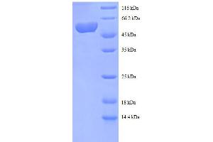 SDS-PAGE (SDS) image for Spermidine Synthase (SRM) (AA 17-302), (partial) protein (GST tag) (ABIN7479595)