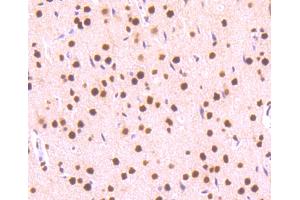 Paraformaldehyde-fixed, paraffin embedded rat liver, Antigen retrieval by boiling in sodium citrate buffer (pH6) for 15min, Block endogenous peroxidase by 3% hydrogen peroxide for 30 minutes, Blocking buffer at 37°C for 20min, Antibody incubation with STAT3(S727) (4G1) Monoclonal Antibody  at 1:50 overnight at 4°C, followed by a conjugated secondary and DAB staining.