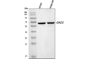 anti-Glutamate Decarboxylase 2 (Pancreatic Islets and Brain, 65kDa) (GAD2) (AA 131-164), (N-Term) antibody