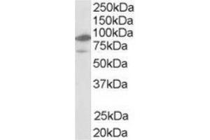 Image no. 1 for anti-Nuclear Receptor Subfamily 1, Group H, Member 2 (NR1H2) (N-Term) antibody (ABIN374475) (NR1H2 antibody  (N-Term))