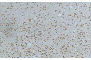 Immunohistochemistry of paraffin-embedded Rat brain tissue using Phospho-CAMK2 beta/gamma/delta (Thr287) Monoclonal Antibody at dilution of 1:200. (CaMK2 beta/gamma/delta (pThr287) antibody)
