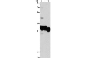 Western Blotting (WB) image for anti-Ketohexokinase (KHK) antibody (ABIN2422886) (Ketohexokinase antibody)