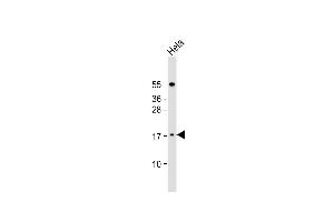 Anti-LSM7 Antibody (C-term) at 1:1000 dilution + Hela whole cell lysate Lysates/proteins at 20 μg per lane.