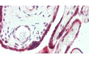Immunohistochemistry of paraffin-embedded Human Placenta using PAPPA Polyclonal Antibody at dilution of 1:100. (PAPPA antibody)