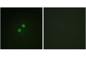 Immunofluorescence analysis of NIH-3T3 cells, using Nibrin (Phospho-Ser278) Antibody. (Nibrin antibody  (pSer278))