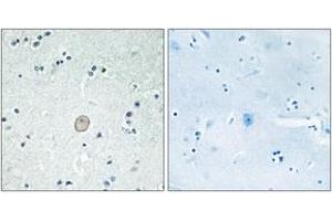 Immunohistochemistry analysis of paraffin-embedded human brain tissue, using C3AR1 Antibody. (C3AR1 antibody  (AA 175-224))