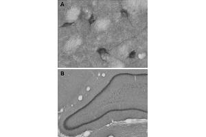 A: Indirect immunohystochemistry of a mouse striatum section (dilution 1 : 100). (ChT antibody  (AA 501-580))