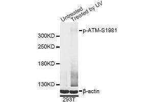 Western blot analysis of extracts of 293T cells, using Phospho-ATM-S1981 antibody (ABIN5969871) at 1/2000 dilution. (ATM antibody  (pSer1981))