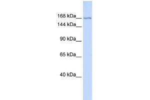 WB Suggested Anti-ZBTB40 Antibody Titration:  0. (ZBTB40 antibody  (Middle Region))