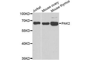 Western blot analysis of extracts of various cell lines, using PAK2 antibody. (PAK2 antibody  (AA 1-212))