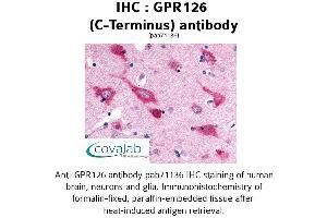 Image no. 1 for anti-G Protein-Coupled Receptor 126 (GPR126) (C-Term) antibody (ABIN1734923) (G Protein-Coupled Receptor 126 antibody  (C-Term))