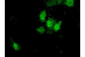 Anti-KHK mouse monoclonal antibody (ABIN2453197) immunofluorescent staining of COS7 cells transiently transfected by pCMV6-ENTRY KHK (RC202424). (Ketohexokinase antibody)