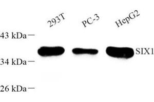 SIX Homeobox 1 antibody