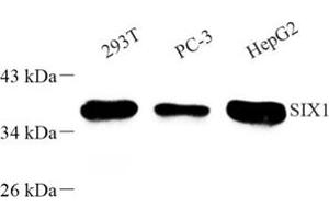 Western blot analysis of SIX1 (ABIN7075617) at dilution of 1: 500 (SIX Homeobox 1 antibody)