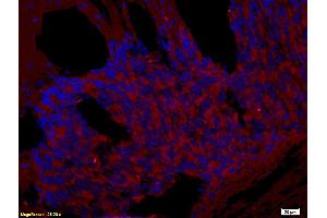 Formalin-fixed and paraffin embedded rat brain tissue labeled with Rabbit Anti-CD272/BTLA Polyclonal Antibody (ABIN671031), Unconjugated at 1:200 followed by conjugation to the secondary antibody and DAB staining. (BTLA antibody  (AA 221-289))