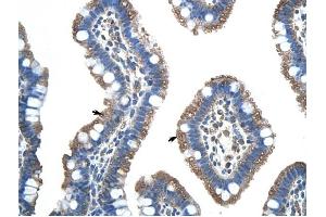 FUS antibody was used for immunohistochemistry at a concentration of 4-8 ug/ml to stain Epithelial cells of intestinal villus (arrows) in Human Intestine.