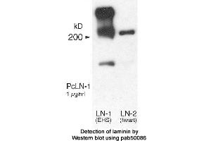 Image no. 1 for anti-Laminin (LN) antibody (ABIN363395) (Laminin antibody)