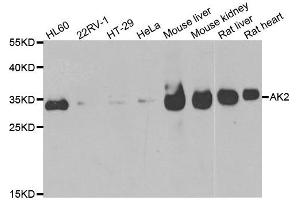 Western blot analysis of extracts of various cell lines, using AK2 antibody. (Adenylate Kinase 2 antibody)