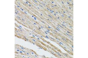 Immunohistochemistry of paraffin-embedded mouse heart using MYOT antibody. (Myotilin antibody  (AA 259-314))