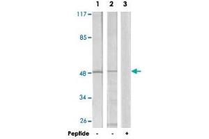 Western blot analysis of extracts from LoVo cells (Lane 1) and NIH/3T3 cells (Lane 2 and lane 3), using TRIP13 polyclonal antibody . (TRIP13 antibody  (C-Term))