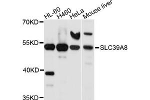 Western blot analysis of extracts of various cell lines, using SLC39A8 antibody (ABIN5998862) at 1/1000 dilution. (SLC39A8 antibody)
