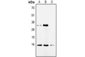Western blot analysis of CDA expression in HepG2 (A), Hela (B), mouse kidney (C) whole cell lysates.