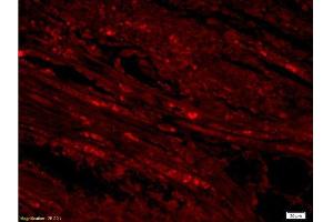 Immunofluorescence (Paraffin-embedded Sections) (IF (p)) image for anti-Apoptosis-Inducing Factor, Mitochondrion-Associated, 1 (AIFM1) (AA 131-230) antibody (ABIN724010)
