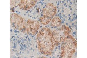 Used in DAB staining on fromalin fixed paraffin- embedded kidney tissue (MCCC2 antibody  (AA 337-563))