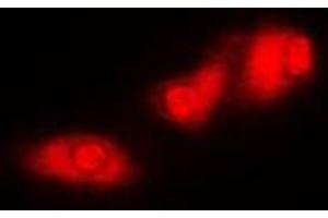 Immunofluorescent analysis of S6K1 staining in MCF7 cells.