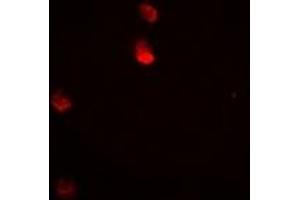 Immunofluorescent analysis of JNK1 staining in Hela cells. (JNK antibody)