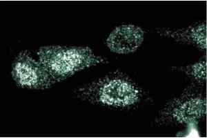 Immunofluorescent staining of HeLa cells. (CD40 antibody  (AA 71-187))