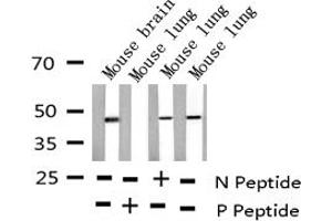 Western blot analysis of Phospho-E2F1 (Thr433) expression in various lysates (E2F1 antibody  (pThr433))