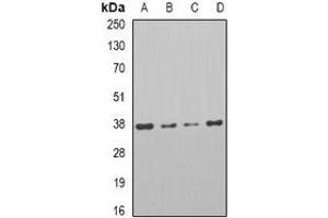 Western blot analysis of PAR6A expression in HT29 (A), Jrukat (B), Raji (C), mouse testis (D) whole cell lysates. (PARD6A antibody)