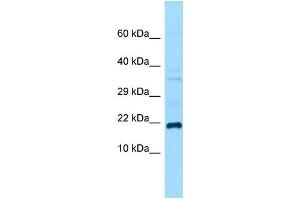 Host:  Rabbit  Target Name:  Grem1  Sample Type:  Mouse Testis lysates  Antibody Dilution:  1.