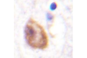 Immunohistochemistry analyzes of DDX3 antibody in paraffin-embedded human brain tissue. (DDX3X antibody)
