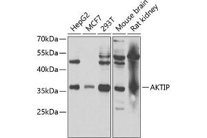 Western blot analysis of extracts of various cell lines, using AKTIP antibody (ABIN6131091, ABIN6136746, ABIN6136748 and ABIN6221837) at 1:1000 dilution.
