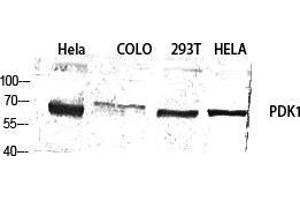 Western Blot (WB) analysis of specific cells using PDK1 Polyclonal Antibody. (PDPK1 antibody  (Thr222))