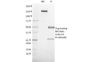 SDS-PAGE Analysis Purified SOX4 Mouse Monoclonal Antibody (SOX4/2540). (SOX4 antibody)
