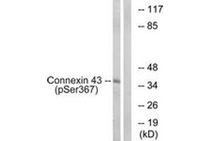 Western blot analysis of extracts from K562 cells treated with PMA 200ng/ml 10', using Connexin 43 (Phospho-Ser367) Antibody. (Connexin 43/GJA1 antibody  (pSer367))