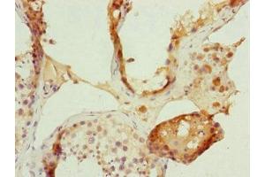 Immunohistochemistry of paraffin-embedded human testis tissue using ABIN7152485 at dilution of 1:100 (FBXL5 antibody  (AA 1-310))