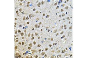 Immunohistochemistry of paraffin-embedded rat brain using PPID Antibody. (PPID antibody  (AA 161-370))