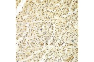 Immunohistochemistry (IHC) image for anti-Lamin A/C (LMNA) (AA 403-572) antibody (ABIN6213722) (Lamin A/C antibody  (AA 403-572))