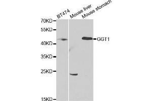 Western blot analysis of extracts of various cell lines, using GGT1 antibody. (GGT1 antibody  (AA 370-569))