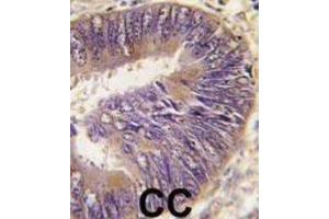 Immunohistochemistry (IHC) image for anti-Suppression of Tumorigenicity 13 (ST13) antibody (ABIN2971014) (HSC70 Interacting Protein HIP antibody)