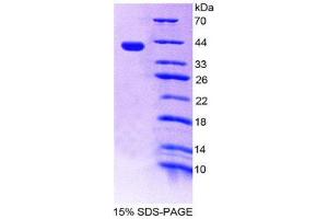 SDS-PAGE (SDS) image for ArfGAP with Dual PH Domains 1 (ADAP1) (AA 45-356) protein (His tag) (ABIN2124285) (ADAP1 Protein (AA 45-356) (His tag))