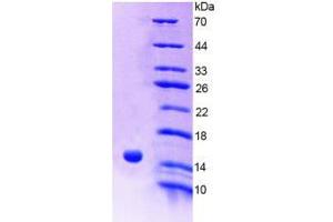 SDS-PAGE (SDS) image for Receptor-Interacting Serine-threonine Kinase 2 (RIPK2) (AA 432-540) protein (His tag) (ABIN6238919)