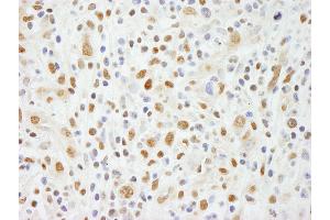Immunohistochemistry (IHC) image for anti-Zinc Finger Protein 335 (ZNF335) (C-Term) antibody (ABIN7453745)